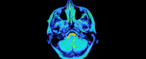 Profound Brain Changes of Pregnancy Revealed in Scientific First