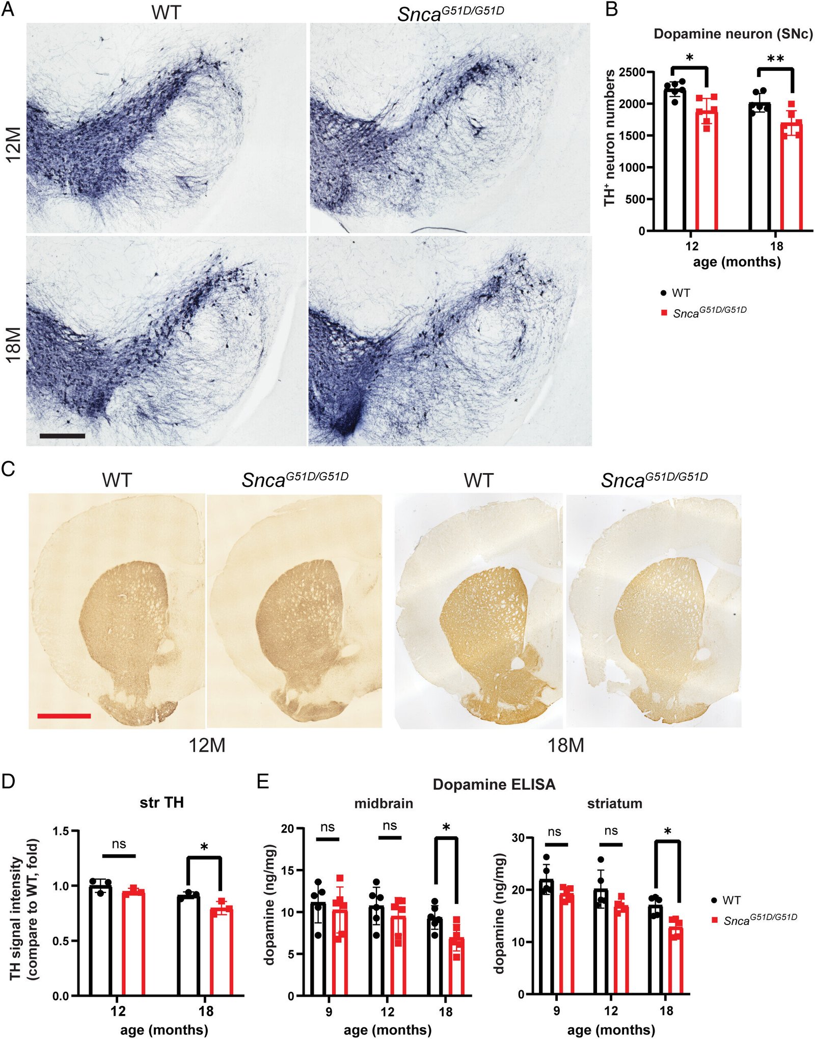 Researchers create mouse model to mimic Parkinson's disease