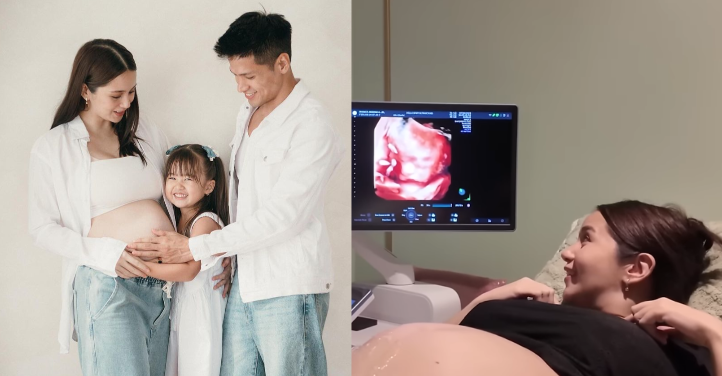 Sophie Albert and Vin Abrenica gender reveal