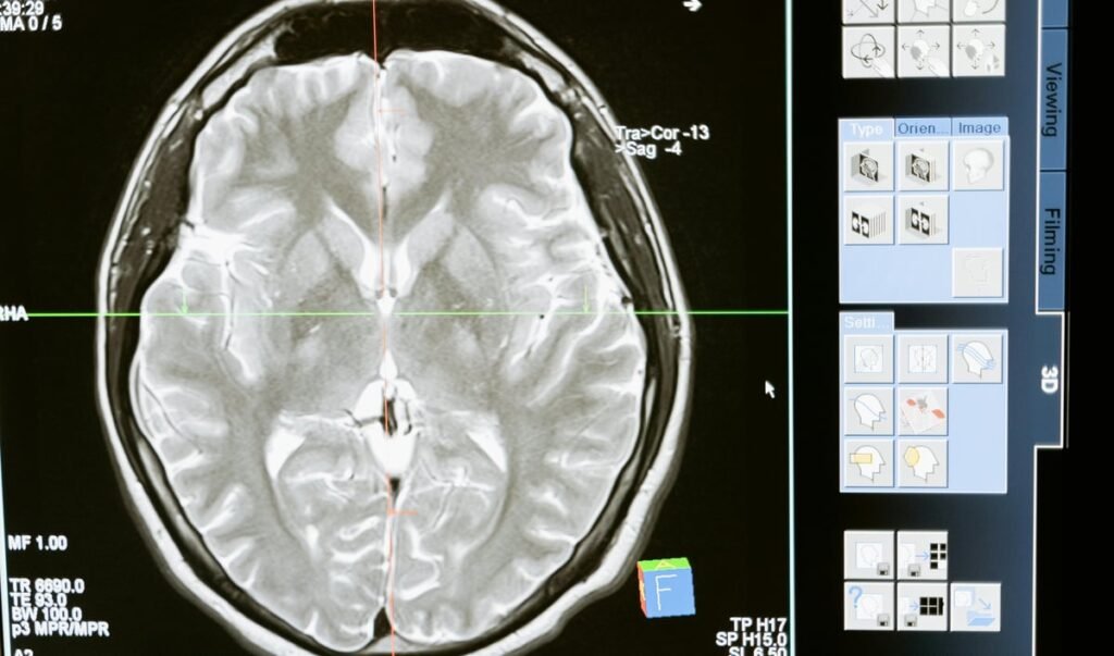 Worried about aneurysm (part 2)