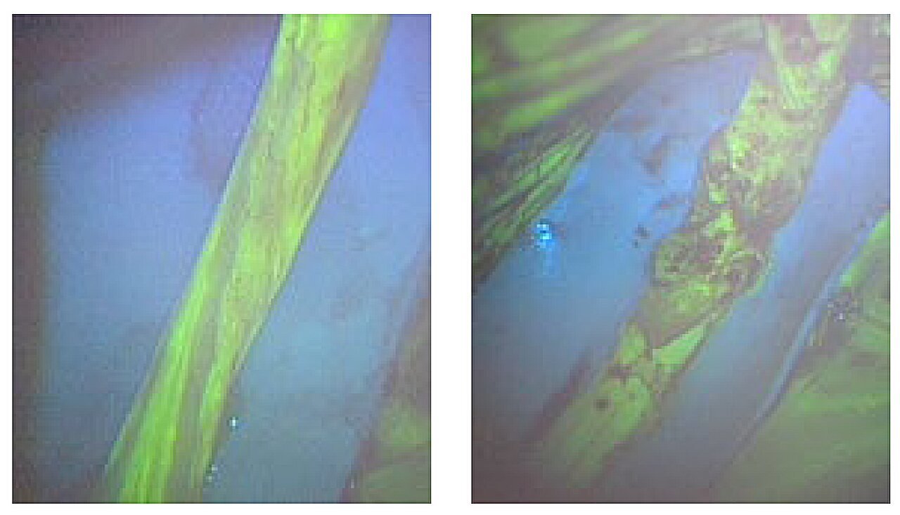 Fluorescent approach could aid carpal tunnel-related surgery