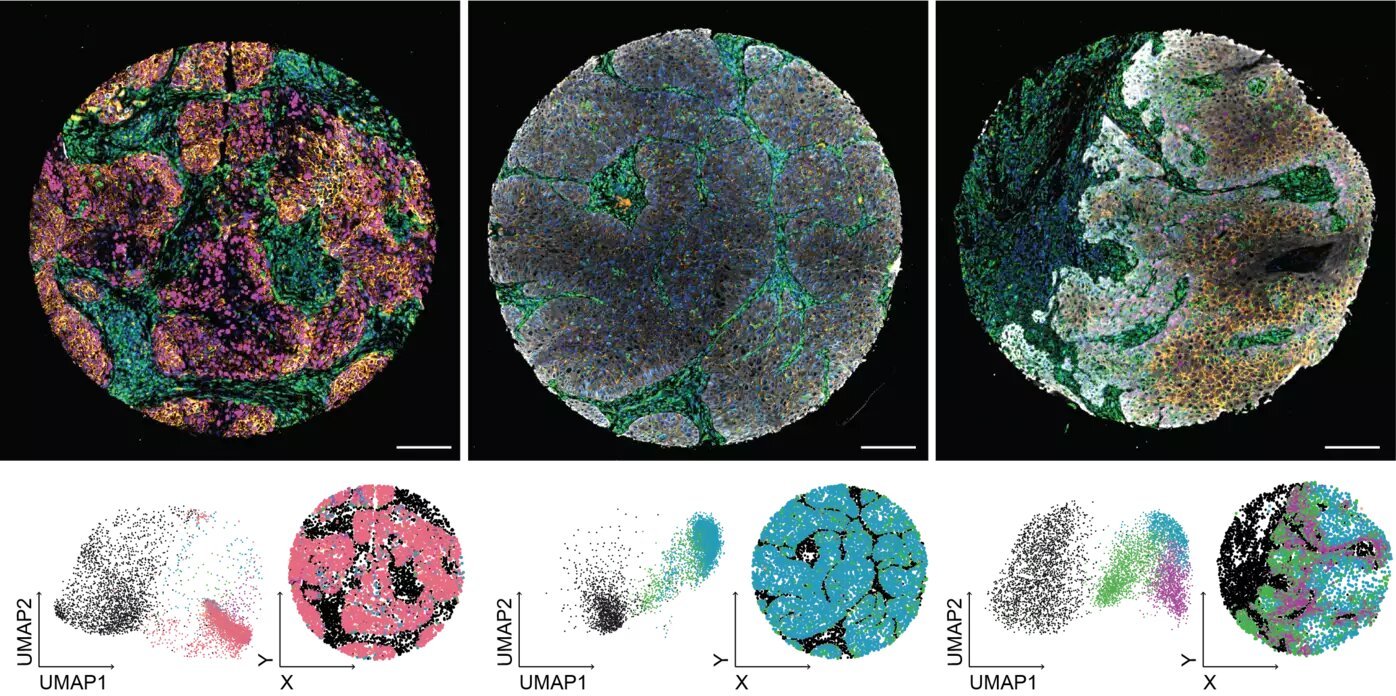 Machine-learning-based method provides a comprehensive diagnosis of head and neck tumors