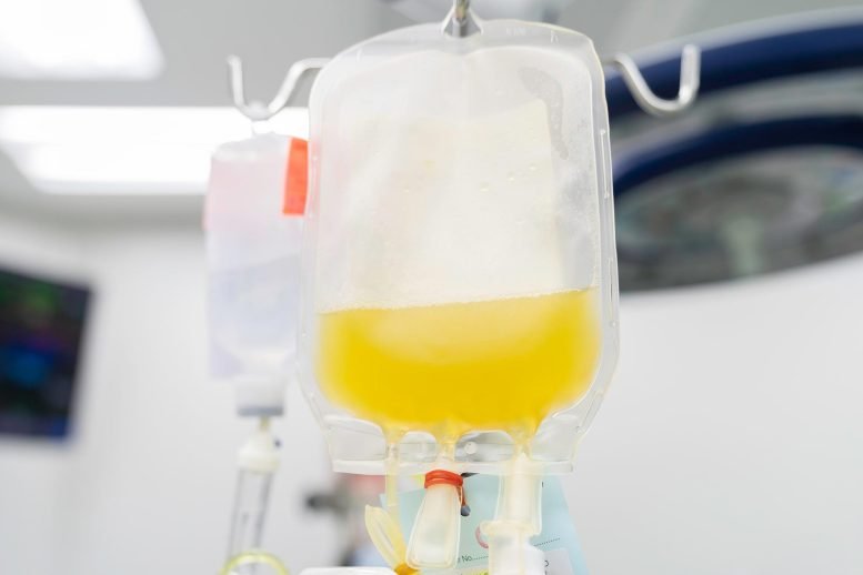 IV Blood Plasma