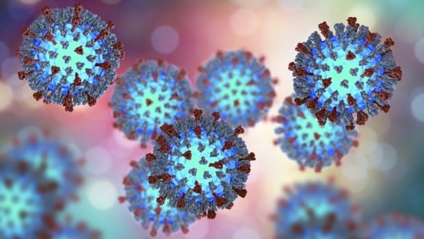 Possible measles exposure at airports in Vancouver, Toronto and Fredericton prompts warning