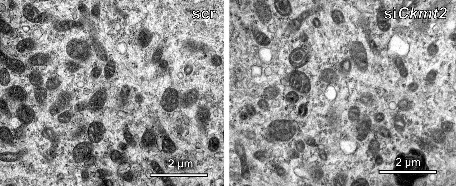 Study shows how muscle energy production is impaired in type 2 diabetes