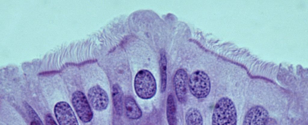 The Origins of The Most Deadly Ovarian Cancer May Have Been Revealed : ScienceAlert