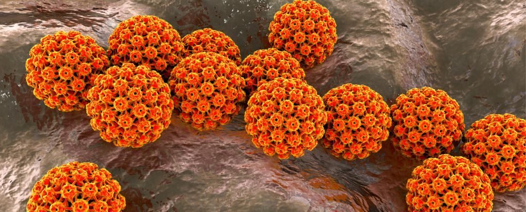 Cancer Threat From Oral HPV Is a Lifelong Risk, But Can Be Prevented : ScienceAlert