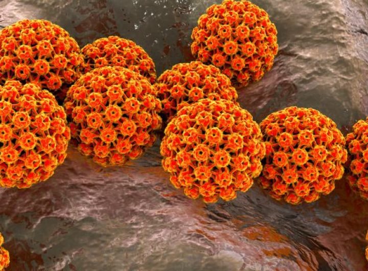 Cancer Threat From Oral HPV Is a Lifelong Risk, But Can Be Prevented : ScienceAlert