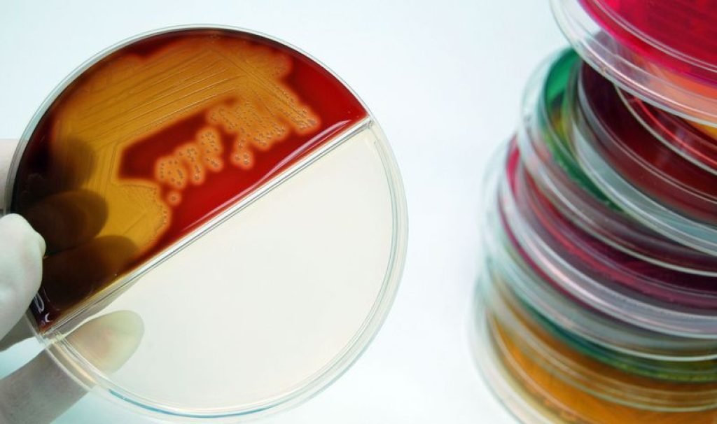 Exploring the Landscape of Bacterial Culture Media