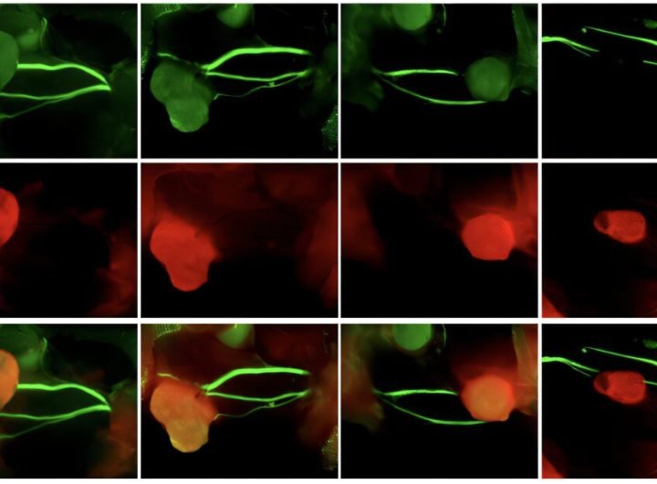 Fluorescence-guided imaging technique could improve head and neck cancer surgery