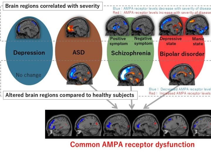 New imaging method sheds light on psychiatric disorders