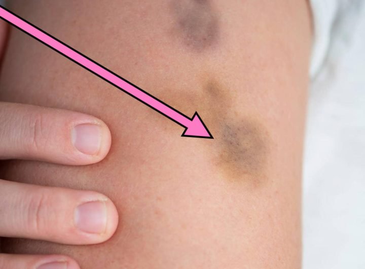 People Are Sharing The Wildest Medical Self-Diagnoses That Actually Turned Out To Be Correct