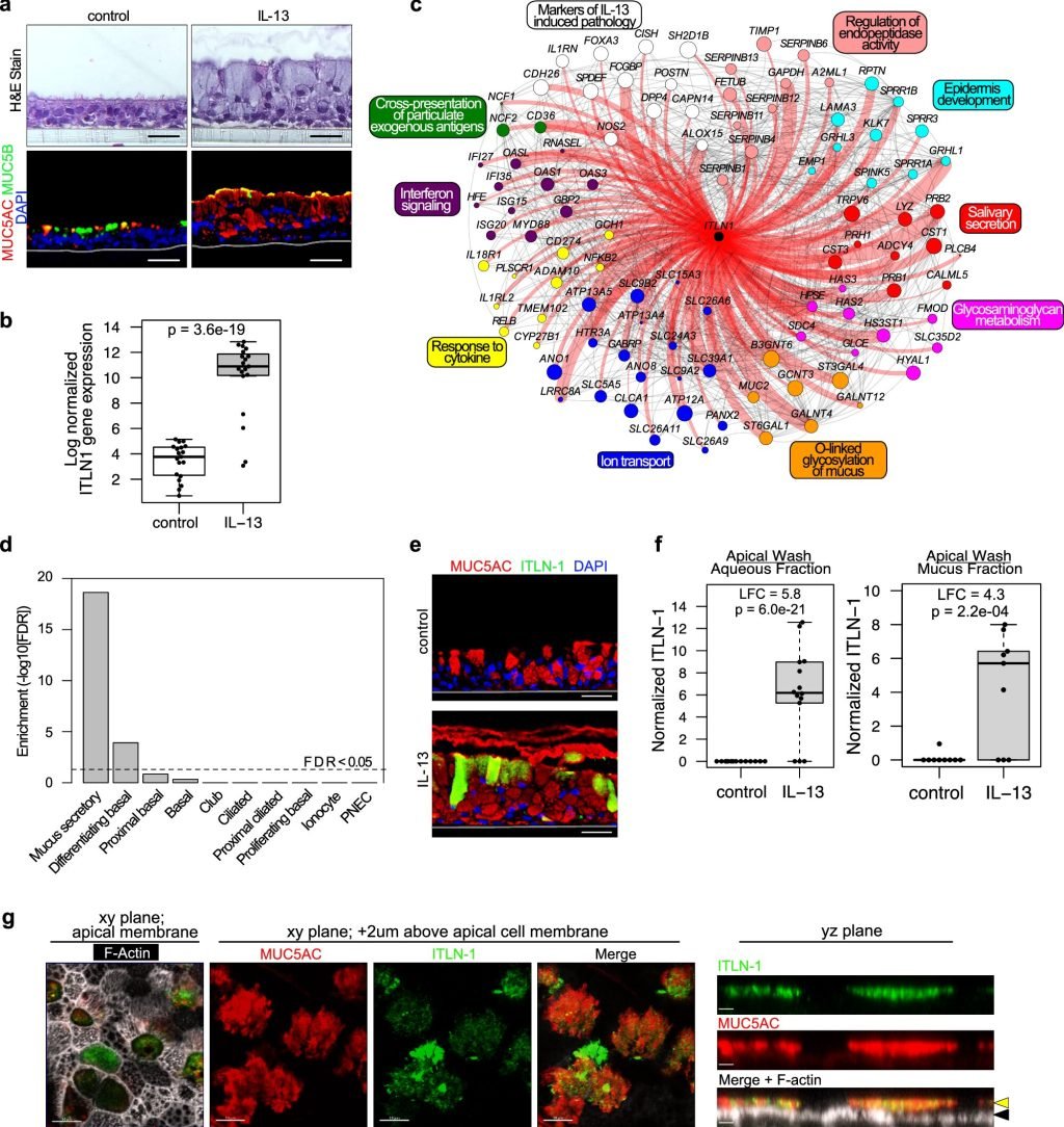 Protein linked to airway obstruction in asthma provides a potential treatment target