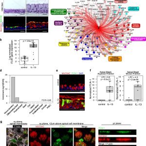 Protein linked to airway obstruction in asthma provides a potential treatment target