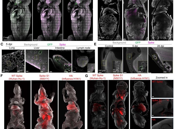 SARS-CoV-2 spike protein accumulation linked to long-lasting brain effects