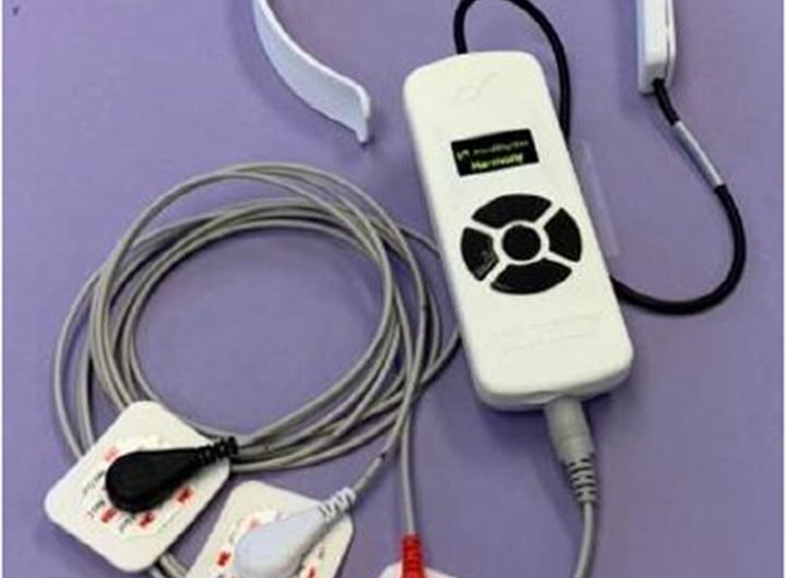 Study highlights feasibility of cranial accelerometry device for prehospital detection of large-vessel occlusion stroke