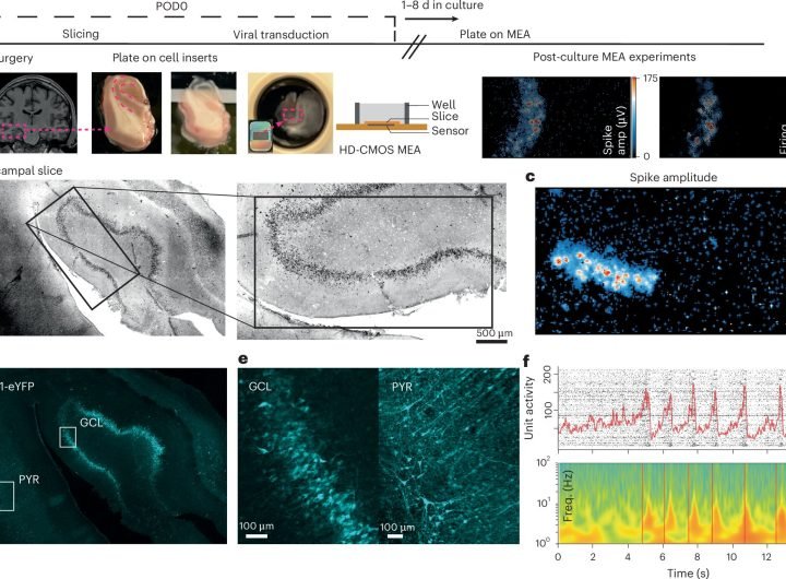 Study shows potential of optogenetics in treating epilepsy