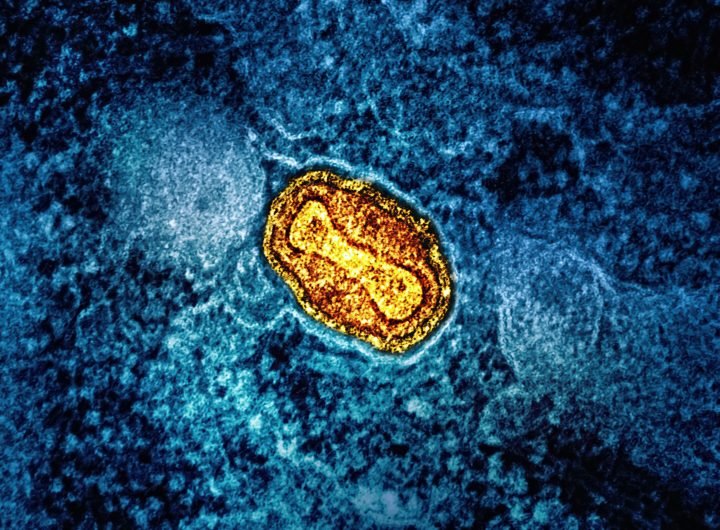 Two UK mpox cases first local transmission in Europe: WHO