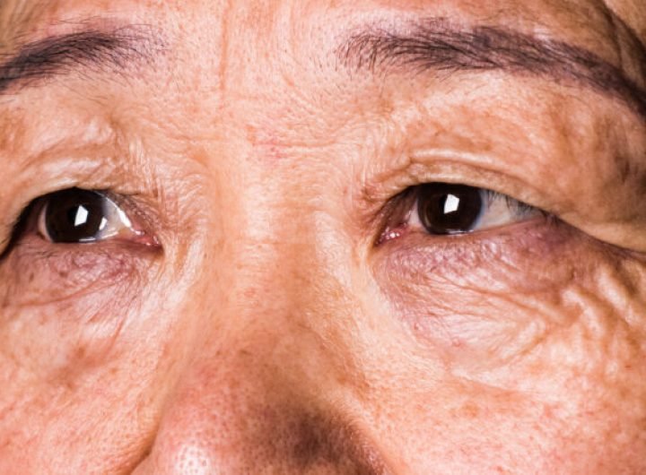 Your Vision Can Predict Dementia 12 Years Before Diagnosis, Study Reveals : ScienceAlert