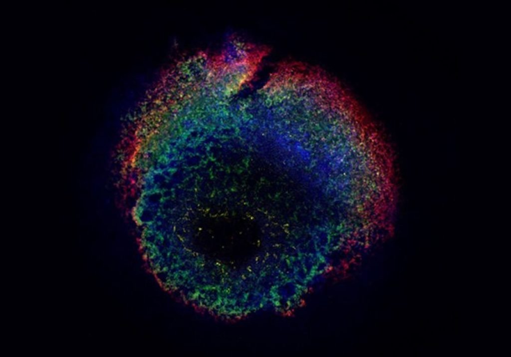 Image of an axon, with a callout box highlighting a portion of the cell membrane. It depicts three different electrodes and ion channels along the membrane.