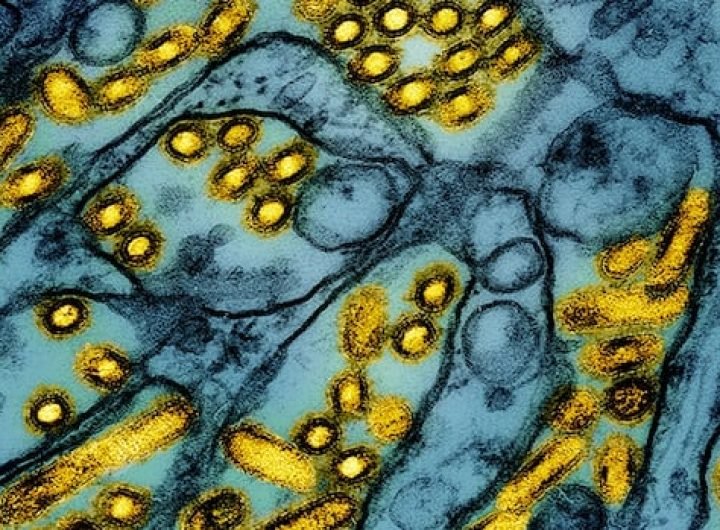 CDC confirms first severe case of H5N1 bird flu in U.S.