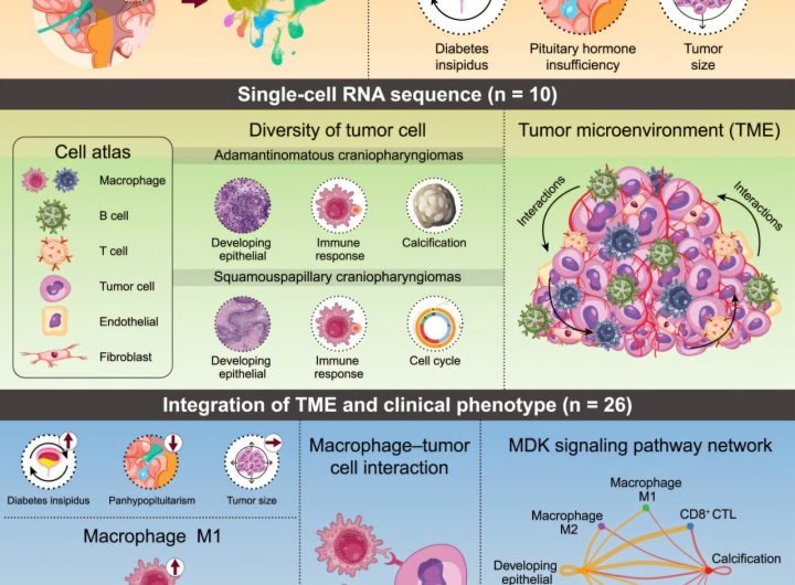 Comprehensive cell map offers insights into rare brain tumor