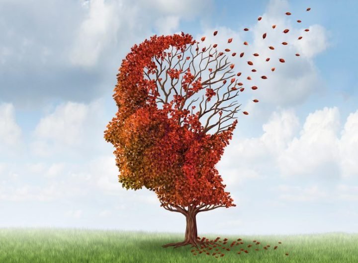 Dementia Declining Brain Cognition