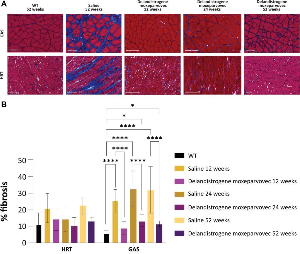 Evaluating long-term survival and cardiac efficacy of a gene therapy for Duchenne muscular dystrophy