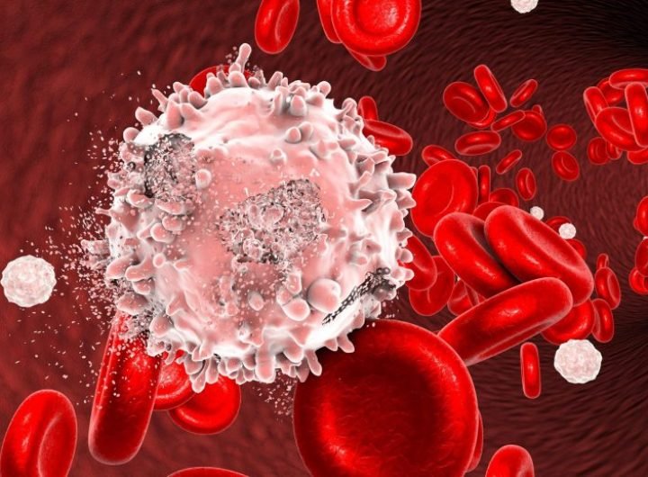 Blood Cancer Illustration