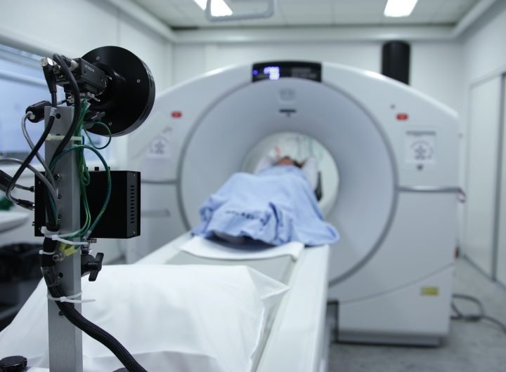 Lung cancer screening with computed tomography finds coronary artery disease in 83% of cases