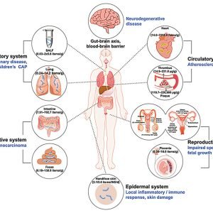 Microplastics found in multiple human organ tissues correlated with lesions