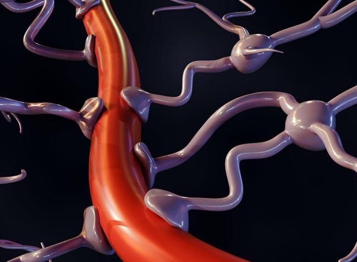 Image of an axon, with a callout box highlighting a portion of the cell membrane. It depicts three different electrodes and ion channels along the membrane.