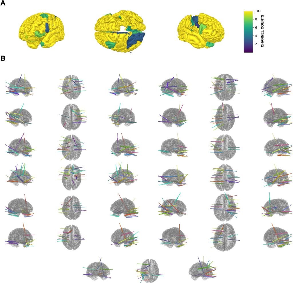 Neurosurgery patients reveal numerical concepts are processed deep in an ancient part of brain