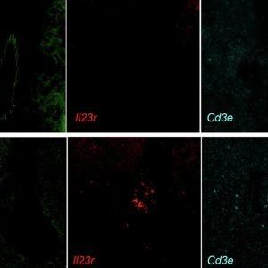 Novel biomarker catches aging cells in the act