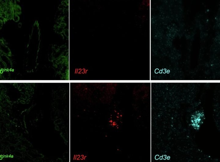 Novel biomarker catches aging cells in the act