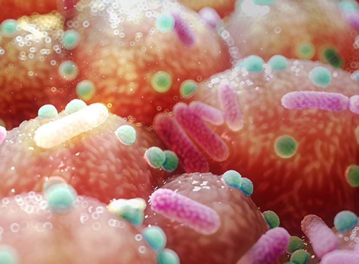 Parkinson's Link to Gut Bacteria Suggests an Unexpected, Simple Treatment : ScienceAlert