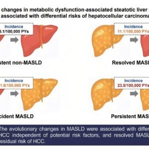 Patients with MAFLD have 4.7 times higher risk of developing liver cancer, study finds