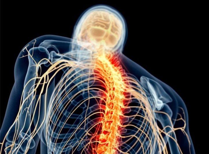 Spinal Cord Nerve Pain Illustration