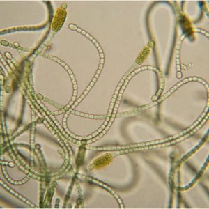 Cyanobacteria