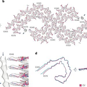 Study explores association between Tau filaments and extracellular vesicles in Alzheimer's disease