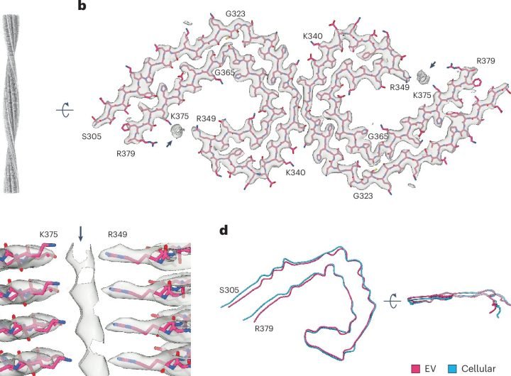 Study explores association between Tau filaments and extracellular vesicles in Alzheimer's disease