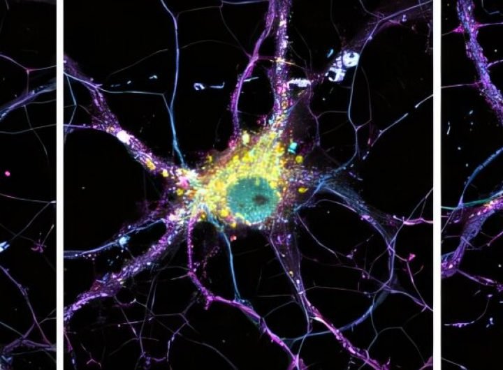 Understanding the genetic roots of rare mutations in Alzheimer's disease