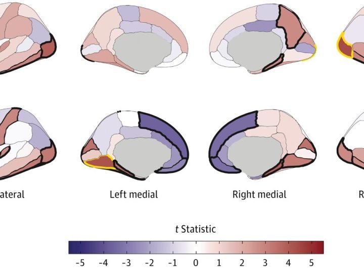 Does substance use change the brain's structure, or does brain structure predispose some to substance use?