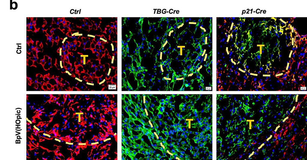 Liver cells' self-defense mechanism against cancer may backfire