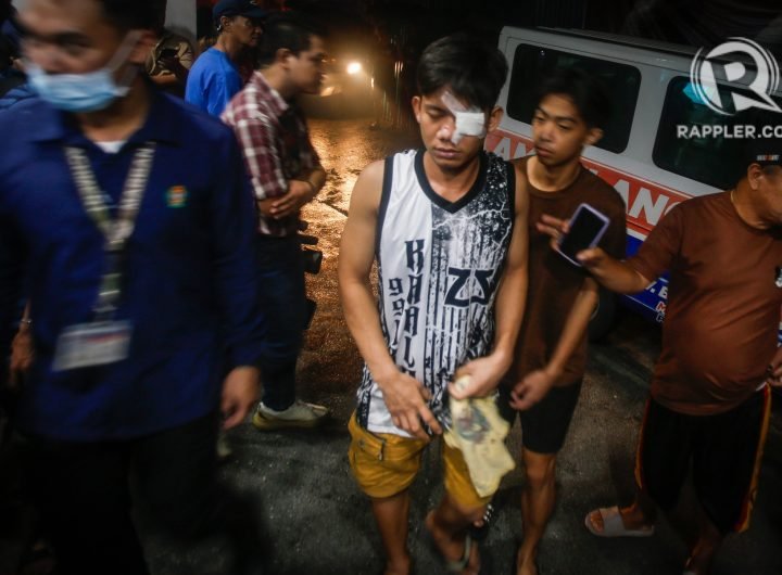 New Year revelers seek treatment for firecracker injuries at the San Lazaro Hospital in Manila, on Wednesday, January 1.  Rappler