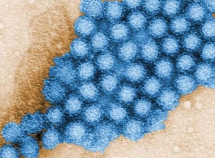 Norovirus cases are on the rise. Here's what you need to know about this nasty bug