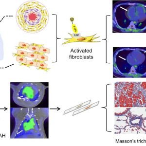 Novel PET approach identifies early signs of pulmonary arterial hypertension