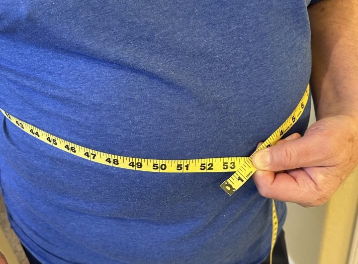 Obesity won't be solely defined by BMI under new plan for diagnosis by global experts