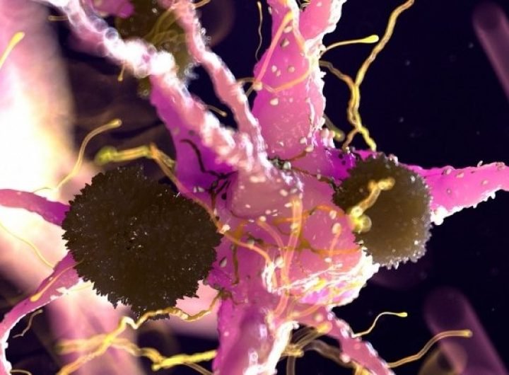 Parkinson's Discovery Suggests We Could Already Have an FDA-Approved Treatment : ScienceAlert