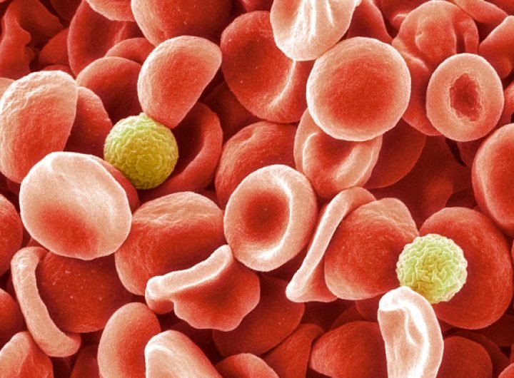 Scientists Identify New Blood Group After 50 Year Mystery : ScienceAlert